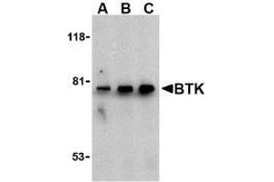 Western blot analysis of BTK in U937 cell lysate with AP30170PU-N BTK antibody at (A) 0. (BTK 抗体  (N-Term))