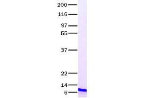 Validation with Western Blot