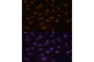 Immunofluorescence analysis of C6 cells using MyoD1 antibody  at dilution of 1:100. (MYOD1 抗体  (AA 150-250))