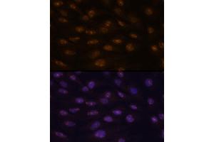 Immunofluorescence analysis of C6 cells using MyoD1 antibody  at dilution of 1:100. (MYOD1 抗体  (AA 150-250))