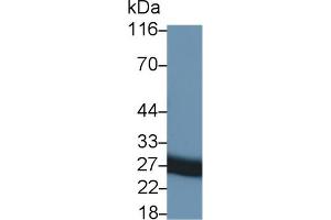 Detection of TIMP1 in Rat Seminal vesicle lysate using Monoclonal Antibody to Tissue Inhibitors Of Metalloproteinase 1 (TIMP1) (TIMP1 抗体  (AA 25-207))