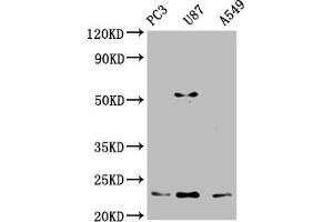 Western Blot Positive WB detected in: PC-3 whole cell lysate, U87 whole cell lysate, A549 whole cell lysate All lanes: FKBP11 antibody at 1:2000 Secondary Goat polyclonal to rabbit IgG at 1/50000 dilution Predicted band size: 23, 16 kDa Observed band size: 23 kDa (FKBP11 抗体  (AA 28-154))