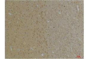 Immunohistochemical analysis of paraffin-embedded Rat BrainTissue using KCNK4 (TRAAK) Rabbit pAb diluted at 1:200. (KCNK4 抗体)