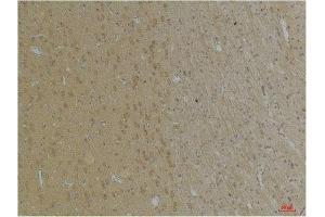 Immunohistochemical analysis of paraffin-embedded Rat BrainTissue using KCNK4 (TRAAK) Rabbit pAb diluted at 1:200. (KCNK4 抗体)