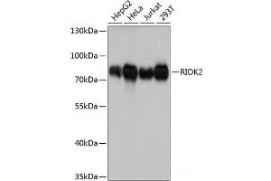Western blot analysis of extracts of various cell lines using RIOK2 Polyclonal Antibody at dilution of 1:3000. (RIOK2 抗体)