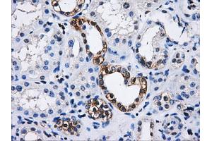 Immunohistochemical staining of paraffin-embedded Kidney tissue using anti-PPME1mouse monoclonal antibody. (PPME1 抗体)