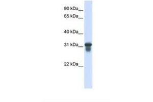 Image no. 1 for anti-Solute Carrier Family 25 (Mitochondrial Carrier, Oxoglutarate Carrier), Member 11 (SLC25A11) (C-Term) antibody (ABIN6738099)
