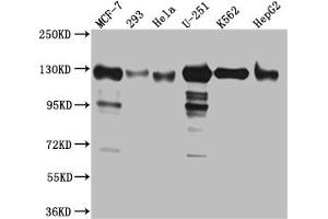 Western Blot Positive WB detected in: MCF-7 whole cell lysate, 293 whole cell lysate, Hela whole cell lysate, U-251 whole cell lysate, K562 whole cell lysate, HepG2 whole cell lysat All lanes: Eg5 Antibody at 1:1000 Secondary Goat polyclonal to rabbit IgG at 1/50000 dilution Predicted band size: 120 kDa Observed band size: 130 kDa (Recombinant KIF11 抗体)