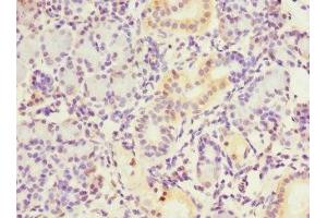 Immunohistochemistry of paraffin-embedded human pancreatic tissue using ABIN7149377 at dilution of 1:100