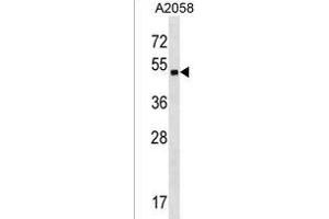 ZN Antibody (Center) (ABIN1538038 and ABIN2850129) western blot analysis in  cell line lysates (35 μg/lane). (ZNF559 抗体  (AA 196-224))