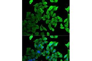 Immunofluorescence analysis of U2OS cells using SEPT2 Polyclonal Antibody (Septin 2 抗体)