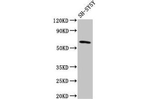 Western Blot Positive WB detected in: SH-SY5Y whole cell lysate All lanes: DEAF1 antibody at 3. (DEAF1 抗体  (AA 73-200))