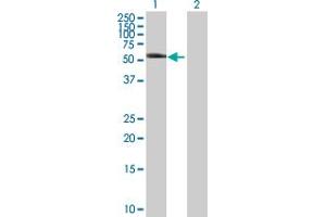 Western Blot analysis of KRT8 expression in transfected 293T cell line by KRT8 MaxPab polyclonal antibody. (KRT8 抗体  (AA 1-483))