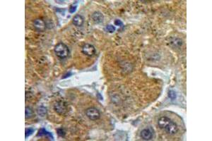 Used in DAB staining on fromalin fixed paraffin-embedded Liver tissue (Fibrinogen beta Chain 抗体  (AA 29-118))