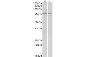ABIN571179 (0. (Dystroglycan 抗体  (Internal Region))