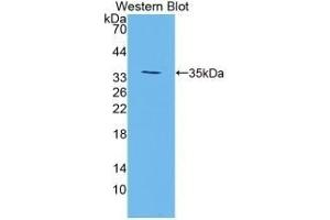 Detection of Recombinant TGM3, Mouse using Polyclonal Antibody to Transglutaminase 3, Epidermal (TGM3) (TGM3 抗体  (AA 468-693))