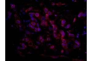 Immunofluorescence (IF) image for anti-RBP1-like protein (ARID4B) (AA 125-175) antibody (ABIN7448931) (BRCAA1 抗体  (AA 125-175))
