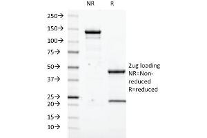 SDS-PAGE Analysis Purified Transglutaminase II Mouse Monoclonal Antibody (SPM358). (Transglutaminase 2 抗体)