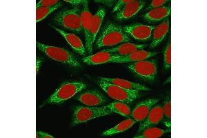 Immunofluorescence Analysis of MeOH-fixed HeLa cells labeled with CDw75 Mouse Monoclonal Antibody (LN-1) followed by goat anti-Mouse IgG-CF488 (Green). (ST6GAL1 抗体)
