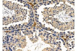 ABIN6257439 and ABIN6276207 at 1/100 staining Mouse testis tissue by IHC-P. (PRLHR 抗体  (Internal Region))