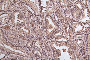Immunohistochemistry of paraffin-embedded human thyroid tissue using ABIN7164566 at dilution of 1:100 (ZDHHC12 抗体  (AA 121-197))
