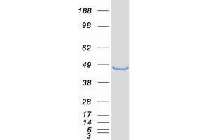 Western Blotting (WB) image for Homer Homolog 2 (HOMER2) (Transcript Variant 1) protein (Myc-DYKDDDDK Tag) (ABIN2722956)