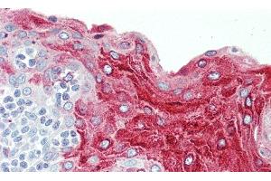 Detection of ECM1 in Human Tonsil Tissue using Polyclonal Antibody to Extracellular Matrix Protein 1 (ECM1) (ECM1 抗体  (AA 20-434))