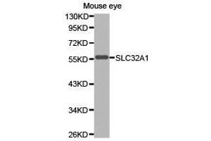 Western Blotting (WB) image for anti-Solute Carrier Family 32 (GABA Vesicular Transporter), Member 1 (SLC32A1) antibody (ABIN1874828) (SLC32A1 抗体)