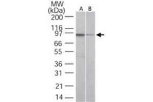 Western blot analysis of TLR5 in A) Ramos and B) Raw cell lysate using TLR5 monoclonal antibody, clone 19D759. (TLR5 抗体  (AA 700-800))