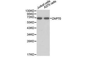 Western Blotting (WB) image for anti-zeta-Chain (TCR) Associated Protein Kinase 70kDa (ZAP70) antibody (ABIN1875382) (ZAP70 抗体)