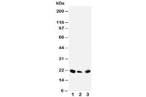 Western blot testing of DUSP3 antibody and Lane 1:  rat testis (Dual Specificity Phosphatase 3 (DUSP3) (C-Term) 抗体)