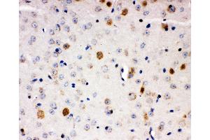 Anti-Aryl hydrocarbon Receptor antibody,  IHC(P) IHC(P): Mouse Brain Tissue (Aryl Hydrocarbon Receptor 抗体  (C-Term))