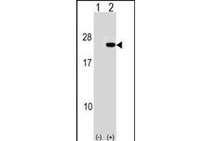 Western blot analysis of IP2 (arrow) using rabbit polyclonal IP2 Antibody (N-term) (ABIN1539498 and ABIN2848464). (PAIP2 抗体  (N-Term))