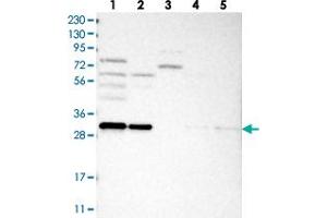 Western blot analysis of Lane 1: RT-4, Lane 2: U-251 MG, Lane 3: Human Plasma, Lane 4: Liver, Lane 5: Tonsil with GEMIN8 polyclonal antibody  at 1:250-1:500 dilution.