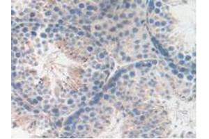 Figure. (LAMP2 抗体  (AA 295-410))