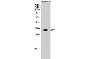 Western Blotting (WB) image for anti-P57 (N-Term) antibody (ABIN3176739) (P57 (N-Term) 抗体)
