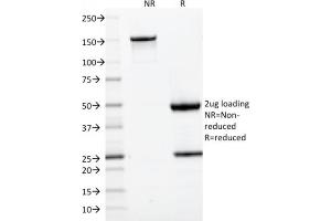 SDS-PAGE Analysis Purified CD22-Monospecific Mouse Monoclonal Antibody (BLCAM/1795).