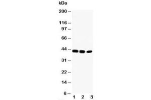 Western blot testing of CCR6 antibody and Lane 1:  rat liver;  2: SW620;  3: CEM cell lysate (CCR6 抗体  (C-Term))