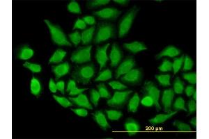 Immunofluorescence of monoclonal antibody to TOMM22 on HeLa cell.