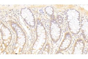 Immunohistochemistry (IHC) image for anti-Syndecan Binding Protein (Syntenin) 2 (SDCBP2) (AA 1-292) antibody (ABIN7435382)