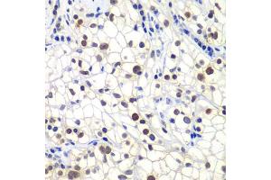 Immunohistochemistry (IHC) image for anti-General Transcription Factor IIF, Polypeptide 2, 30kDa (GTF2F2) (AA 1-249) antibody (ABIN6141494)