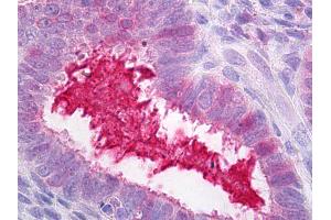 Anti-SERPING1 / C1INH antibody IHC of human uterus, endometrium.