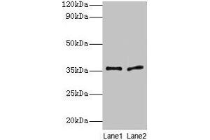 Western blot All lanes: Plaur antibody at 2 μg/mL Lane 1: 293T whole cell lysate Lane 2: Rat brain tissue Secondary Goat polyclonal to rabbit IgG at 1/10000 dilution Predicted band size: 36, 25 kDa Observed band size: 36 kDa (PLAUR 抗体  (AA 25-299))