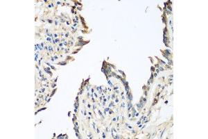 Immunohistochemistry of paraffin-embedded human lung using GPI antibody.