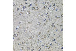Immunohistochemistry (IHC) image for anti-Collagen, Type I, alpha 2 (COL1A2) antibody (ABIN6570116)
