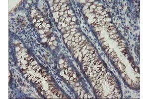 Immunohistochemical staining of paraffin-embedded Human colon tissue using anti-SENP2 mouse monoclonal antibody. (SENP2 抗体  (AA 139-523))