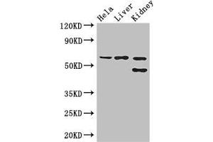 Western Blot Positive WB detected in: Hela whole cell lysate, Mouse liver tissue, Mouse kidney tissue All lanes: EHD2 antibody at 3 μg/mL Secondary Goat polyclonal to rabbit IgG at 1/50000 dilution Predicted band size: 62, 47 kDa Observed band size: 62, 47 kDa (EHD2 抗体  (AA 401-543))