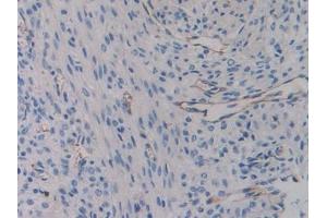 Detection of ITGb3 in Mouse Uterus Tissue using Polyclonal Antibody to Integrin Beta 3 (ITGb3) (Integrin beta 3 抗体  (AA 134-376))