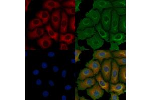 ABIN6256835 and ABIN6273684 staining Hela cells by IF/ICC. (Cytokeratin 1 抗体  (N-Term))