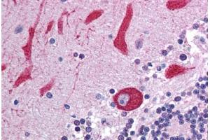 Human Brain, Cerebellum (formalin-fixed, paraffin-embedded) stained with TLR7 antibody ABIN214002 at 5 ug/ml followed by biotinylated goat anti-rabbit IgG secondary antibody ABIN481713, alkaline phosphatase-streptavidin and chromogen. (TLR7 抗体)